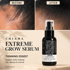 Chiama Extreme Grow Hairline Serum | Peptide Hair Density & Scalp Serum