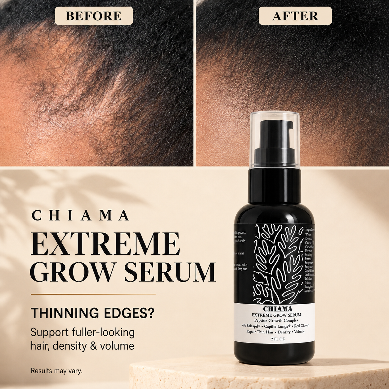 Chiama Extreme Grow Hairline Serum | Peptide Hair Density & Scalp Serum