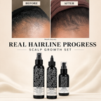 Chiama Extreme Grow 3-Step Scalp & Edge Hair System | Hydrating Mist + Growth Serum + Hair Oil