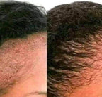 Close-up before and after comparison of scalp showing improved hair density and texture